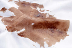 4 Simple Steps To Remove Chocolate Stains From The Couch