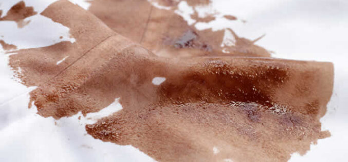 4 Simple Steps To Remove Chocolate Stains From The Couch